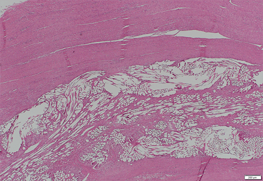 Rapid cellular infiltration by 6 weeks image